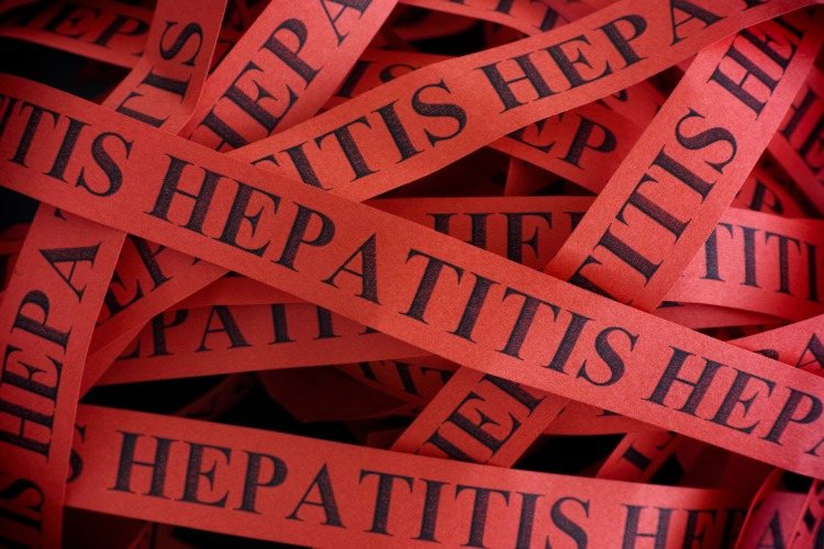 rote bänder aus papier mit hepatitis aufschrift in schwarz