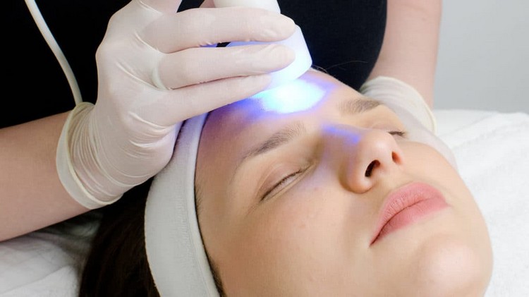 Lichttherapie mit Blaulicht gegen Akne welche Nebenwirkungen