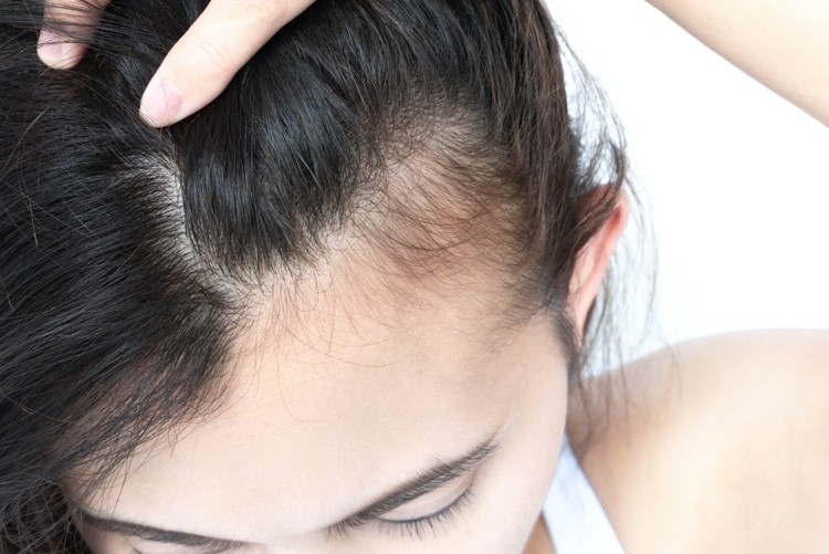 Muskatellersalbei gegen Haarausfall anwenden