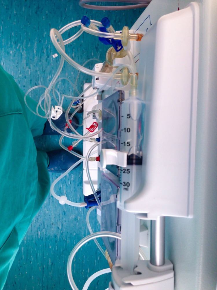medizinisches gerät im krankenhaus vorbereiten bei covid 19 patienten mit zytokinsturm
