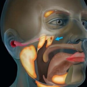 niederländische wissenschaftler entdecken neues organ im rachenraum