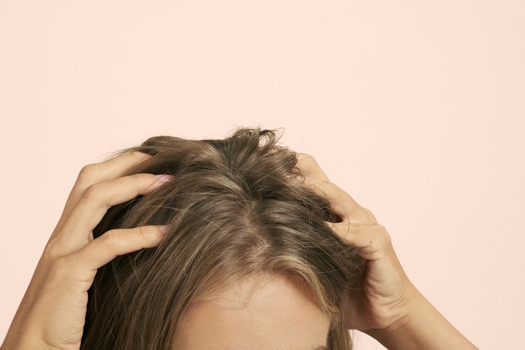 Kann man Haaröl gegen Schuppen im Haaransatz anwenden
