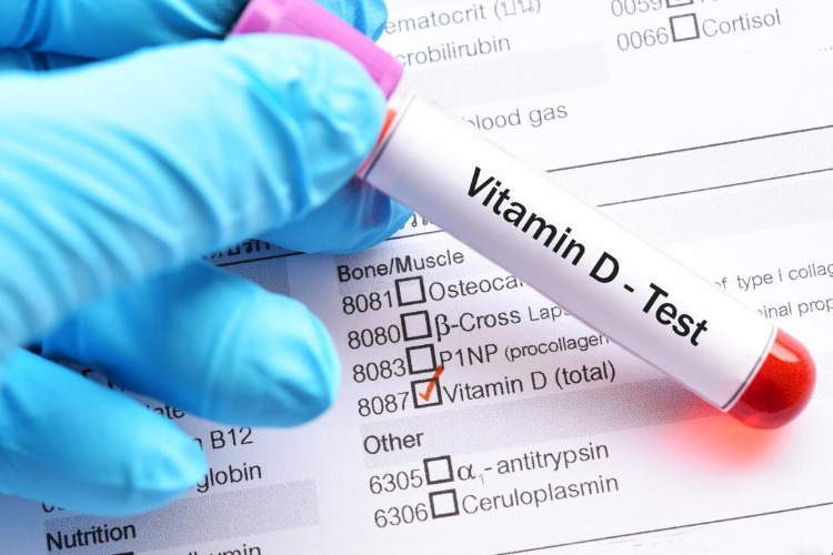 blutprobe zum testen der menge von vitamin d