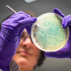 forscherin analysiert probe vom darmmikrobiom im labor