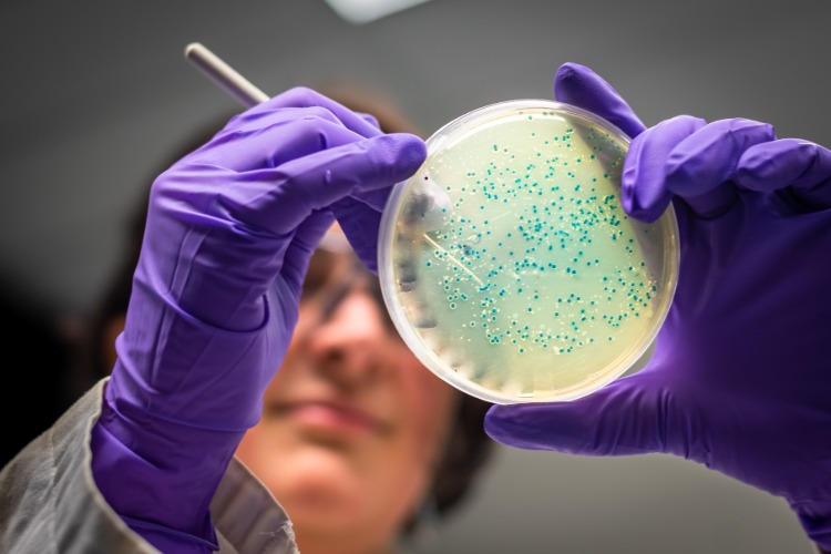 forscherin analysiert probe vom darmmikrobiom im labor