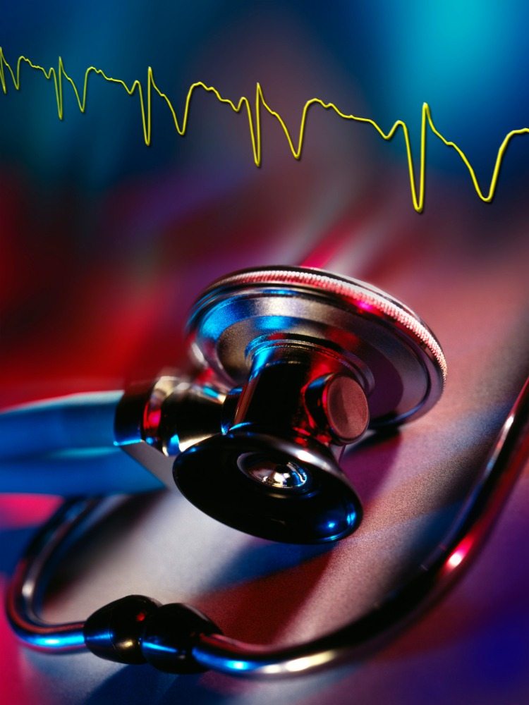 stethoskop und erhöhter puls als zeichen für herzprobleme in medizin