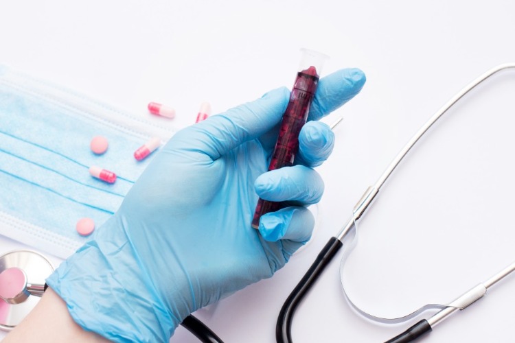 test auf hiv und tuberkulose während der covid 19 pandemie