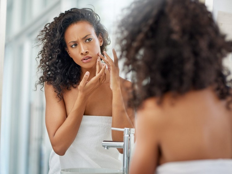 was ist Cacay Öl Hautpflege Tipps bei Akne Gesichtsöle Wirkung