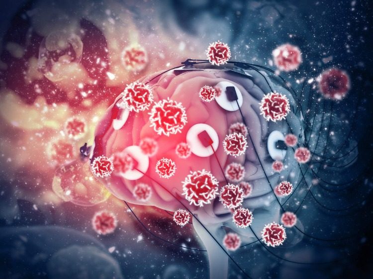 coronavirus im gehirn durch riechschleimhaut kann neurologische schäden verursachen