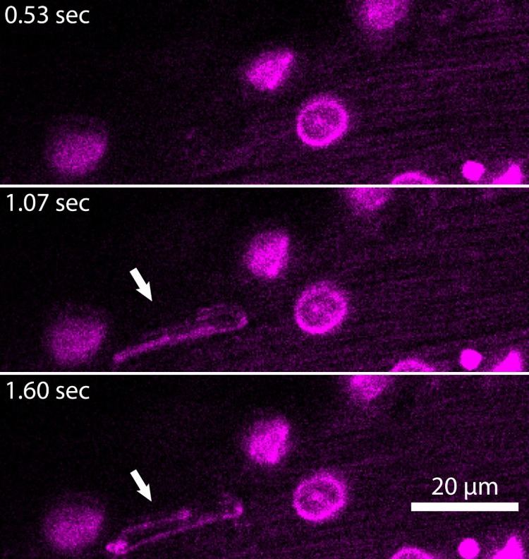 neue mikropartikel durch neutrophile im blut bei sepsis im blutbild entdeckt