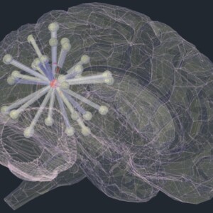 wie breitet sich alzheimer krankheit im gehirn aus