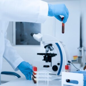 forscher im labor analysiert blutprobe vom patient mit erhöhtem cholesterinspiegel