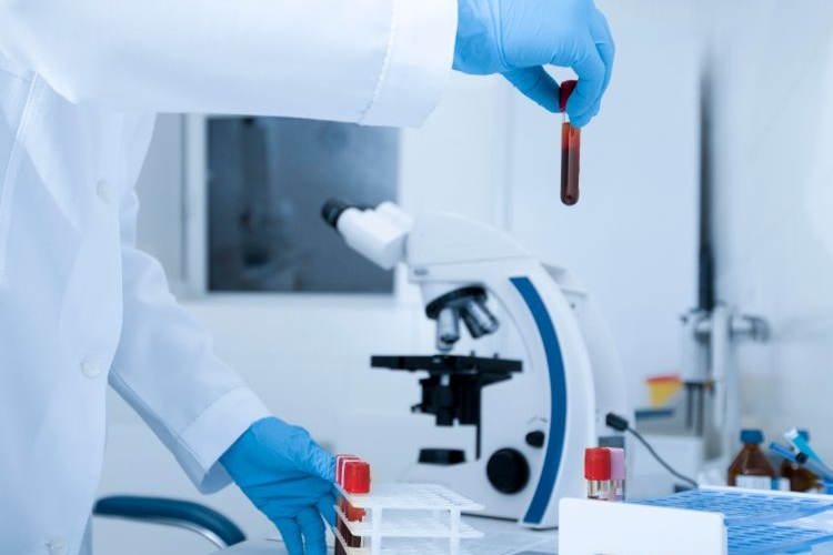 forscher im labor analysiert blutprobe vom patient mit erhöhtem cholesterinspiegel