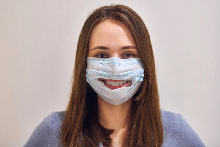 lächelnde frau mit schutzmaske zeigt ihre zahnspange während der covid 19 pandemie