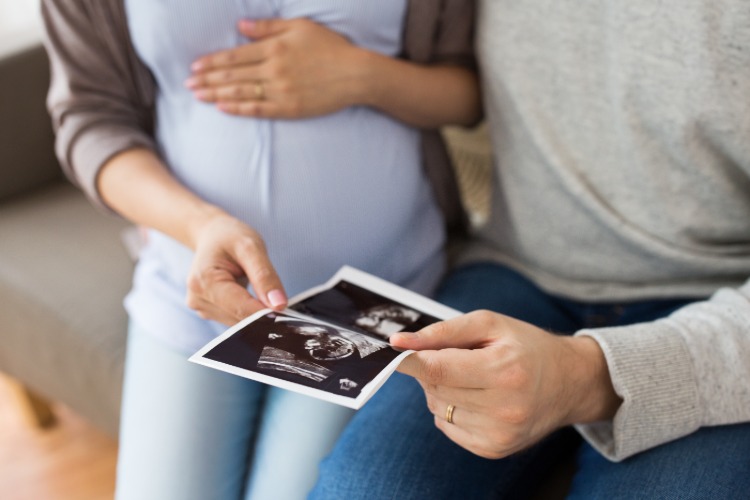 schwangere frau hält ein foto vom ultraschall nach untersuchung des fötus