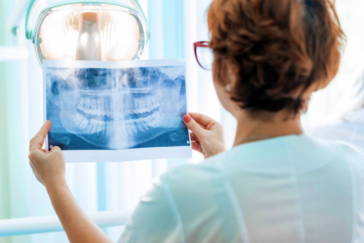 zahnärztin analysiert röntgenaufnahme von zahnfleischerkrankungen bei menschen