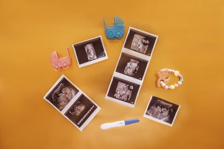 aufnahmen von ungeborenen babys mit ultraschall weisen auf das geschlecht hin