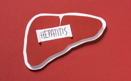 neuer therapieansatz gegen nichtalkoholische steatohepatitis in sicht