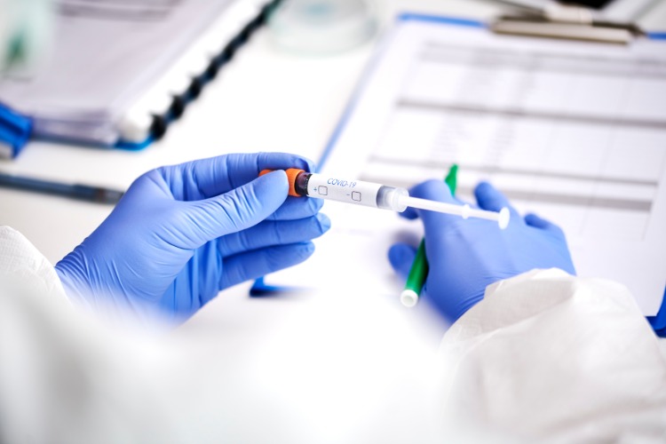 postiver test auf coronavirus aus blutprobe im labor