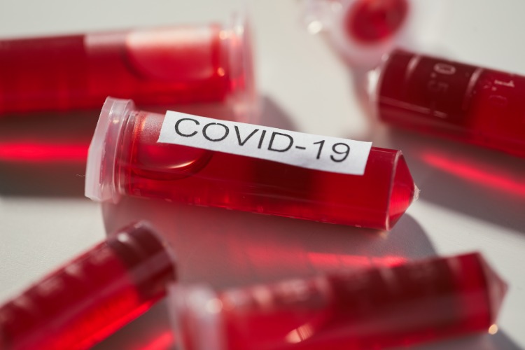 von covid 19 bevorzugte blutgruppe a führt zu häufigere infektionen mit sars cov 2