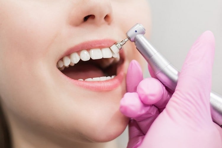 Parodontitis Folgen wie Bluthochdruck sind gefährlich Zähne beim Zahnarzt reinigen
