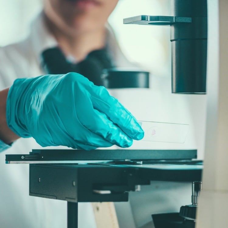 Un ricercatore in laboratorio esamina il campione al microscopio