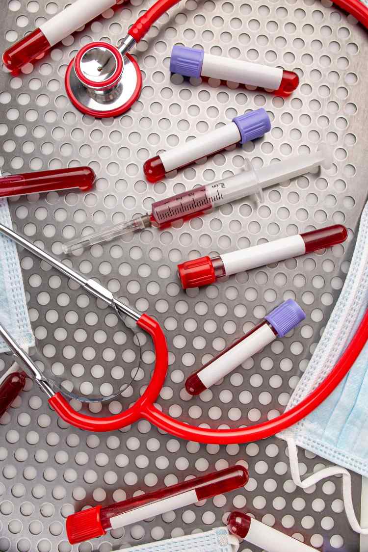im krankenhaus gesammelte blutproben von patienten mit thrombosen nach impfung gegen covid 19