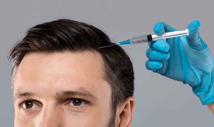 mesotherapie gegen haarausfall bei männern mit spritzen