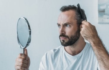 Erblich bedingter Haarausfall bei Männern Ursachen