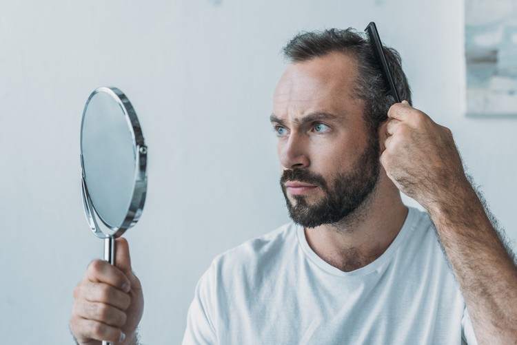 Erblich bedingter Haarausfall bei Männern Ursachen
