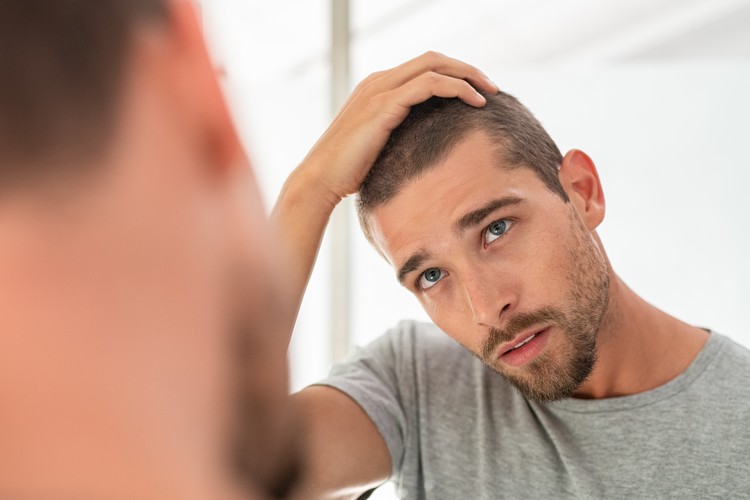 Haarausfall bei Männern bin ich betroffen