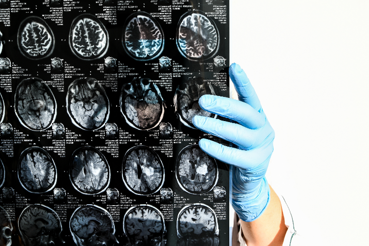 arzt analysiert gehirnscan vom patient mit verdacht auf neurologische erkrankung
