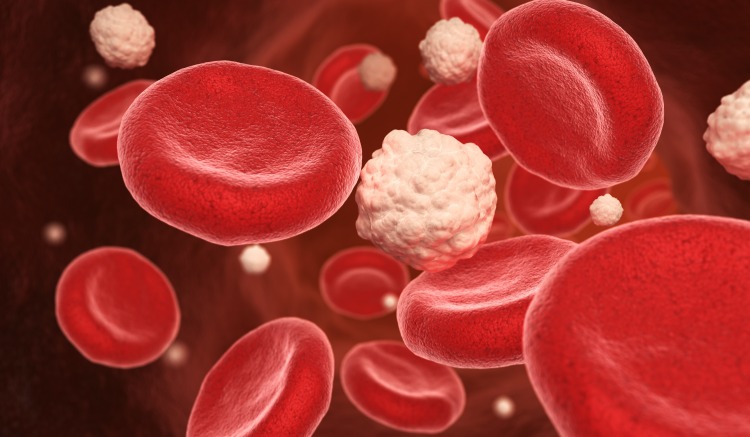atherosklerotische plaques entstehen bei zuckerkrankheit durch entzündliche makrophagen im blut