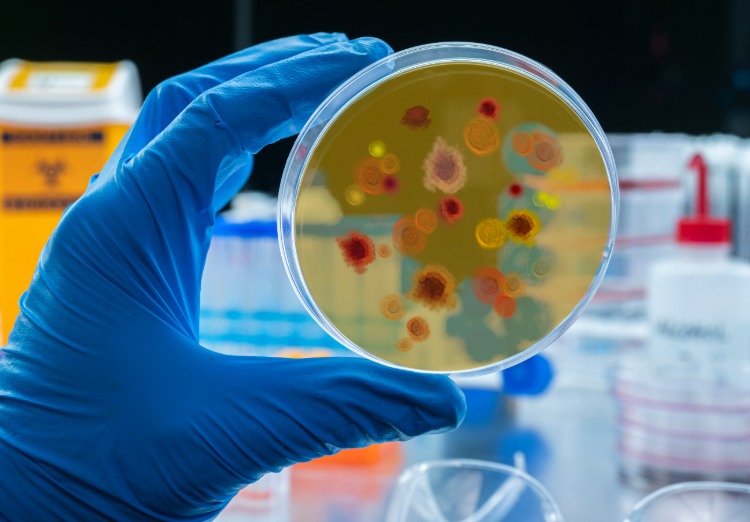 bakterien und viren in petrischale werden von einem forscher im labor analysiert