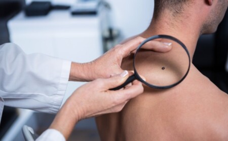 dermatologe untersucht patient bevor behandlung von hautkrebs und melanom