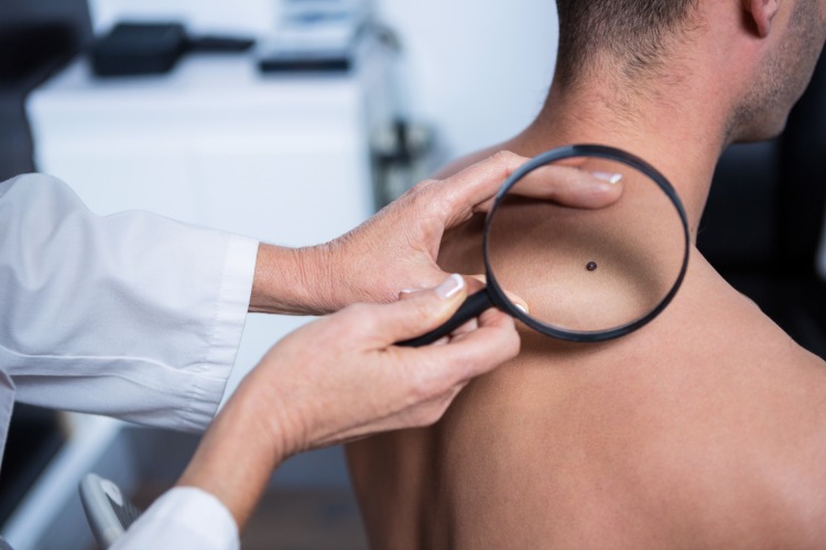 dermatologe untersucht patient bevor behandlung von hautkrebs und melanom