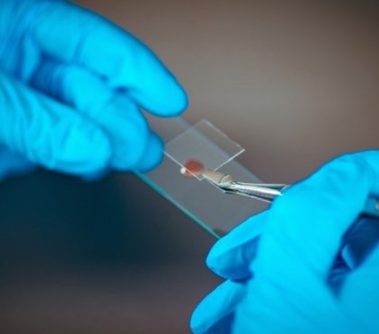 neue forschungen verwenden monoklonale antikörper zur entwicklung von impfstoffen