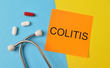 potenzielle neue behandlung von colitis ulcerosa und chronischen darmerkrankungen