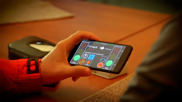 smartphone von patient mit diabetes bei nierendialyse nutzt künstliche bauchspeicheldrüse