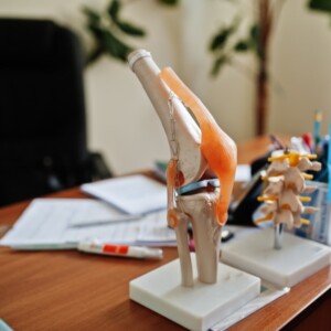 künstliches modell von kniegelenk zu medizinischen zwecken in der orthopedie