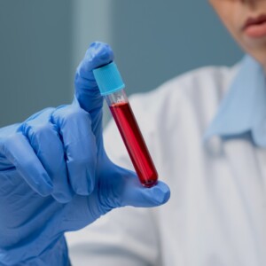 wissenschaftlerin hält eine blutprobe von patient mit demenzerkrankungn