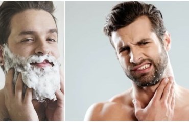 Was kann man gegen Schuppen im Bart tun
