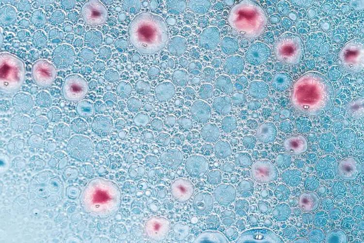 ausbreitung von krebs und metastasierung von tumoren unter mikroskop bei krebsforschung