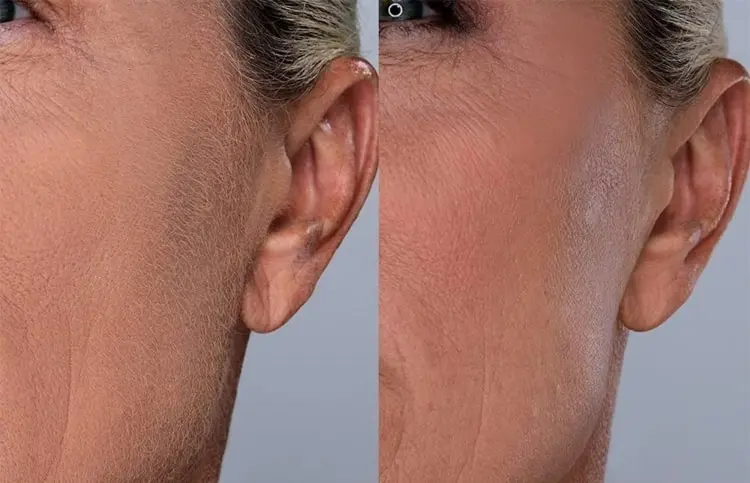 Dank der Gesichtsrasur lässt sich Make-up besser und weniger sichtbar auftragen