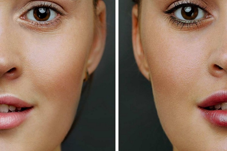 Was sind die Vorteile von Nanoblading Augenbrauen vs. Microblading