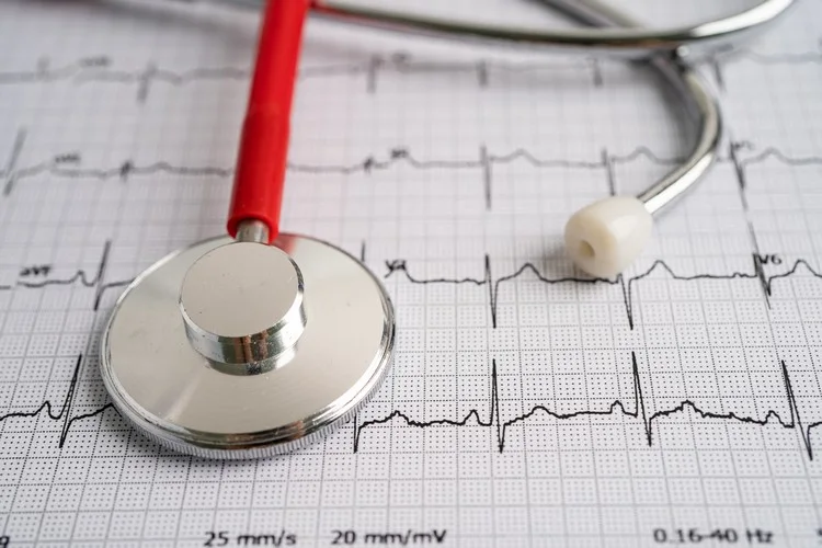 EKG Beschädigungen an der Herzmuskulatur aufspüren