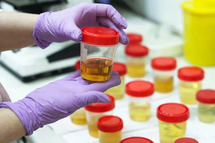forscher untersucht urinprobe als mögliche variante zum düngen von pflanzen