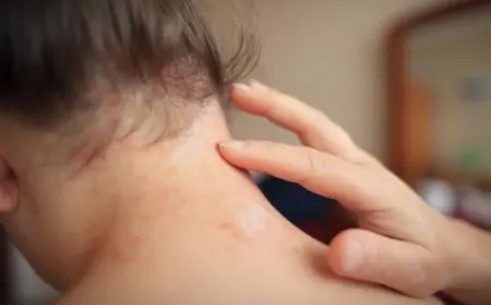 Hitzepickel bei Kindern behandeln mit Hausmitteln