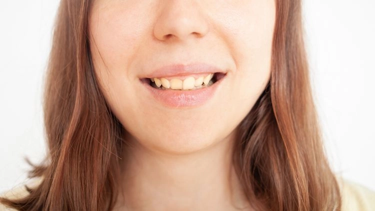 Was hilft gegen gelbe Zähne - Tipps und Ideen