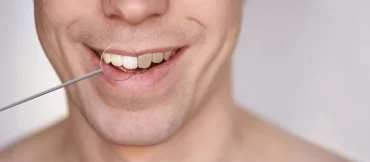 Was tun gegen gelbe Zähne